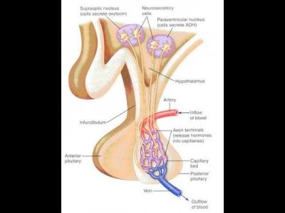 Diabetul insipid